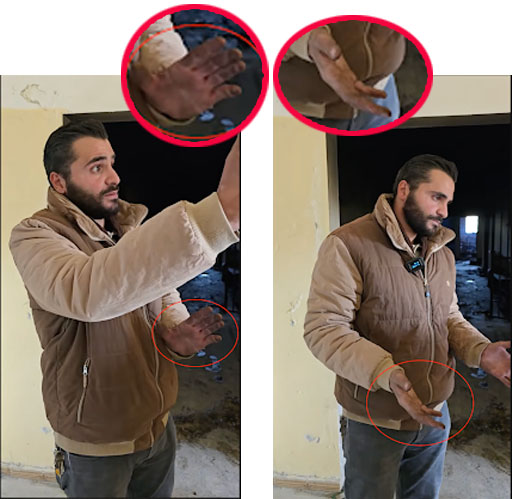 علامات سواد على اليدين اليمنى واليسرى لـ"أنس مجذوب".